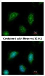 C2CD2 Antibody in Immunocytochemistry (ICC/IF)