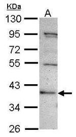 C2CD2 Antibody in Western Blot (WB)