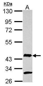 AIM2 Polyclonal Antibody