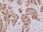 PRKD3 Polyclonal Antibody