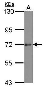 PRKD3 Antibody in Western Blot (WB)
