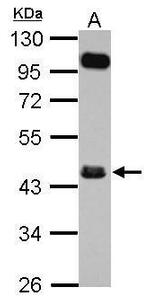 FCRLA Polyclonal Antibody