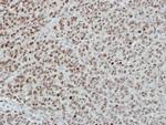 INTS4 Antibody in Immunohistochemistry (Paraffin) (IHC (P))
