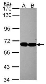 INTS4 Antibody in Western Blot (WB)