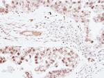 ZNF501 Antibody in Immunohistochemistry (Paraffin) (IHC (P))
