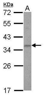 ZNF501 Antibody in Western Blot (WB)