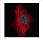 ZNF449 Polyclonal Antibody