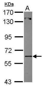ZNF449 Antibody in Western Blot (WB)