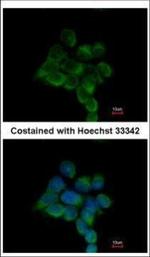 ILKAP Polyclonal Antibody