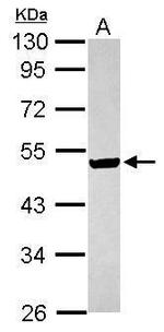 ILKAP Antibody in Western Blot (WB)