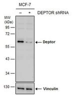 DEPDC6 Antibody