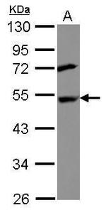 DEPDC6 Antibody in Western Blot (WB)