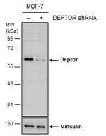 DEPDC6 Polyclonal Antibody