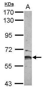ZNF83 Polyclonal Antibody