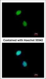 POLE3 Polyclonal Antibody