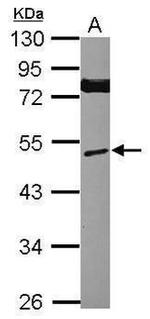 Mig-6 Antibody in Western Blot (WB)