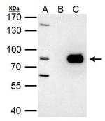 PRMT7 Antibody in Immunoprecipitation (IP)