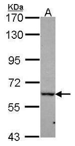 DDX56 Polyclonal Antibody