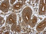 P4HTM Polyclonal Antibody