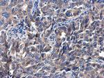 P4HTM Polyclonal Antibody