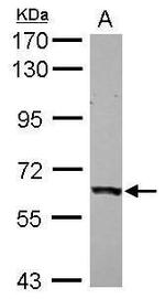 P4HTM Antibody in Western Blot (WB)