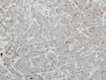 FBLIM1 Polyclonal Antibody