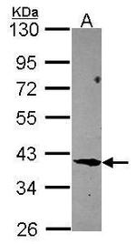 FBLIM1 Antibody in Western Blot (WB)