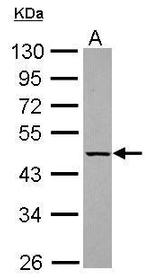 KLHDC4 Antibody in Western Blot (WB)