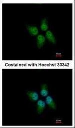 KLHDC4 Polyclonal Antibody