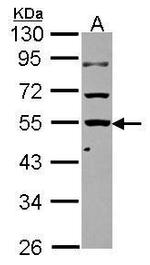 KLHDC4 Antibody in Western Blot (WB)