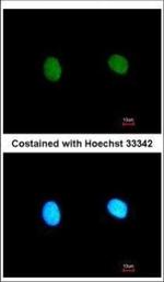 MED18 Polyclonal Antibody