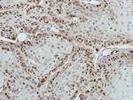 MED18 Antibody in Immunohistochemistry (Paraffin) (IHC (P))