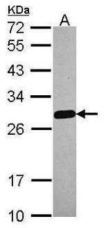 MED18 Antibody in Western Blot (WB)