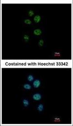 ZNF83 Polyclonal Antibody