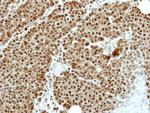 ZNF83 Antibody in Immunohistochemistry (Paraffin) (IHC (P))