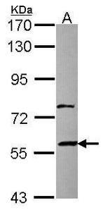 ZNF83 Antibody in Western Blot (WB)