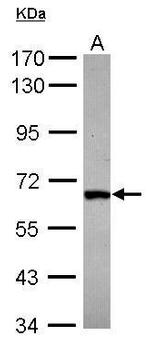 DDX28 Antibody in Western Blot (WB)