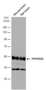 PPP2R2D Antibody in Western Blot (WB)