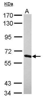 NXF2 Antibody in Western Blot (WB)
