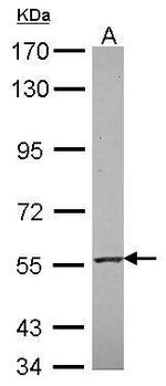 RNF23 Antibody in Western Blot (WB)