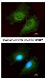 AKR1B10 Polyclonal Antibody