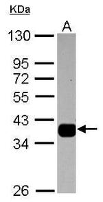 AKR1B10 Antibody in Western Blot (WB)