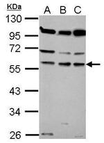 Coronin 1B Polyclonal Antibody