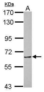 MTA3 Polyclonal Antibody