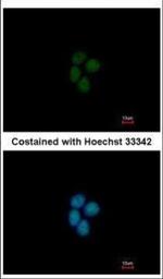 p400 Polyclonal Antibody