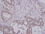 GBA3 Polyclonal Antibody