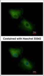 CXCL16 Polyclonal Antibody