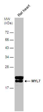 MYL7 Antibody in Western Blot (WB)