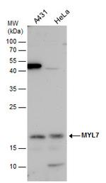 MYL7 Antibody in Western Blot (WB)