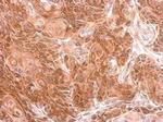SIGIRR Antibody in Immunohistochemistry (Paraffin) (IHC (P))